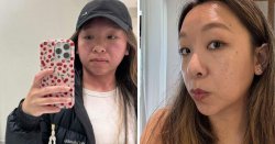 'La Roche-Posay's hydrating serum sped up my skin recovery after microneedling'