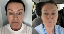 Amazon anti-ageing serum that has shopper &#039;delaying&#039; injectables now 34% off