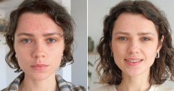 Face mask has shoppers saying there&#039;s &#039;no visible wrinkles anymore&#039; is now £100 off