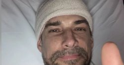 Actor in hospital dash &#039;nearly died&#039; after suffering &#039;deformed&#039; skull&#039;