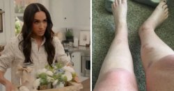 Meghan Markle threatened with £8m lawsuit after Netflix bath salts hack results in ‘burns&#039;