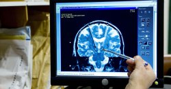 Psychopaths have a VERY different brain size to the rest - and it&#039;s not what you think