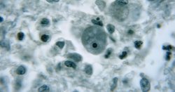 Horror as nine-year-old dies from a rare infection caused by ‘brain-eating amoeba’