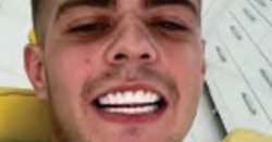 Police catch drug dealer after he sends pal picture of new 'Turkey teeth'