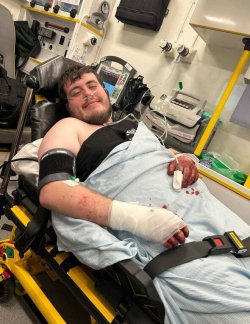 Hero bystander seriously injured saving life of mum and baby from horror dog attack